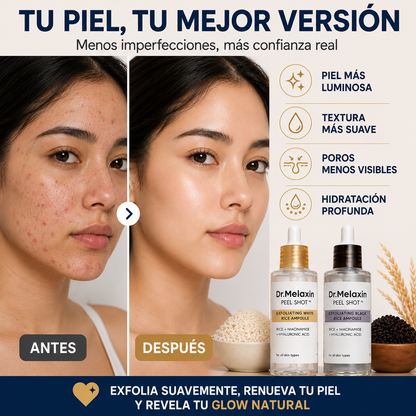 RiceLumi™ Glow Peel